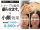 ベルフルール VIP店の写真