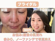 ナーナモエ(na-namoe)の雰囲気（ブライダル支持率NO.1）