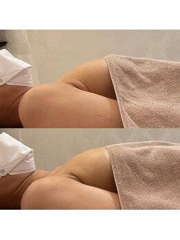 アネラ(ANERA) 心斎橋/産後ママのバストアップ!/育乳