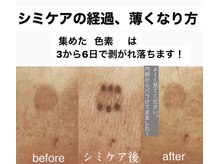 ファミリーセルフサロン 輪(Wa)/シミケア