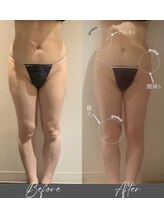 インフィニーズ(INFINEEZ)/カスタマイズ90分痩身脚30代