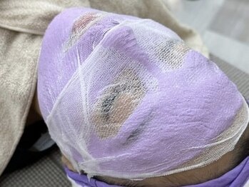 プラチナ ヒーリング(PLATINUM HEALING.)の写真/マリムーブフェイシャルワックスで産毛を脱毛し、つるスベ美肌に♪お得なクーポンも多数ご用意◎