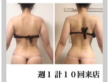 アーク(ARC)/上半身痩身60分 before/after