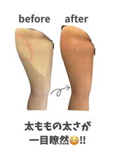 フューチャーズ ミィー(futures mii)/脂肪分解☆部分改善