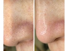 サイ(Sai)/before⇒after