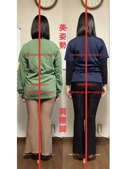 たか施術院/セルフケレッスン日常が練習場所