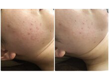 クレビア(CREBIA)/