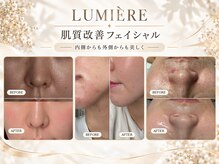リュミエール(LUMIERE)