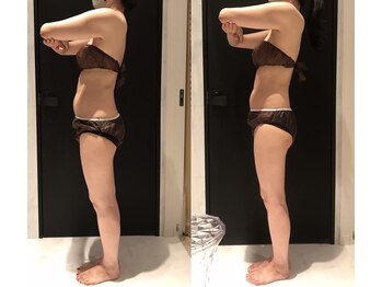 リボディ 表参道(An re Body)/before→after