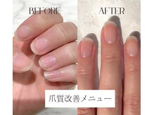 ネイルラボ レモンツリー(Nail Lab LEMON TREE)の雰囲気（爪にコンプレックスを抱える方に最短3ヶ月で縦長の美しい爪へ）