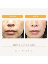 ムーンライズ(moonrise)/