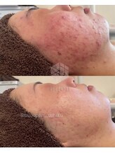 ビジュープラス ひたち野うしく店(Bijou+)/