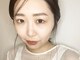 ベルアイラッシュ(vel-eyelash)の写真