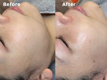 クリスタルビューティ 渋谷/NEW【XE'LHAセラピール】