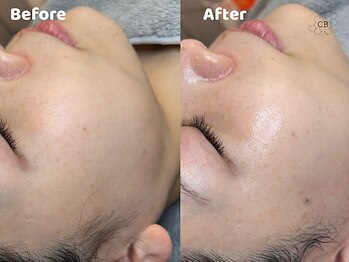 クリスタルビューティ 渋谷/NEW【XE'LHAセラピール】