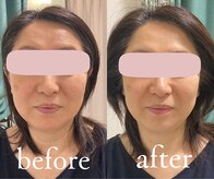 トリートメントルーム フェリーチェ(Felice)