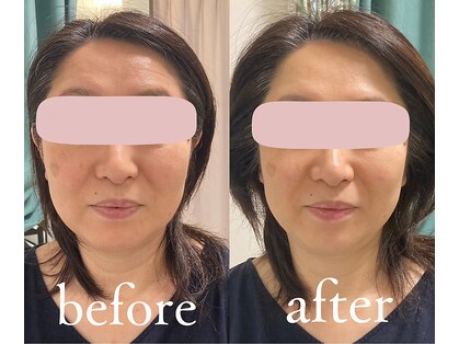 トリートメントルーム フェリーチェ(Felice)の写真