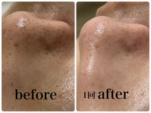 プリヴィエレジェ(privilegie)/