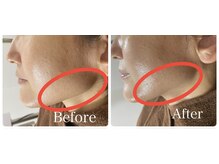 オレンジ(Orange)/