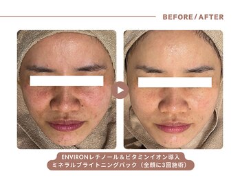 イエス マイサロン(yes My Salon)/ENVIRONトリートメント症例