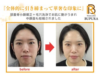 ブプラ つくば店(BUPURA)/before→after　１