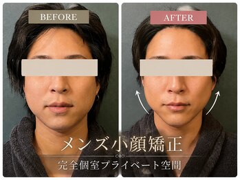 ラメール(La mer)の写真/第一印象で差をつけるデキる男の身だしなみ★凝り固まった表情筋をほぐして引き締まった精悍なフェイスへ！