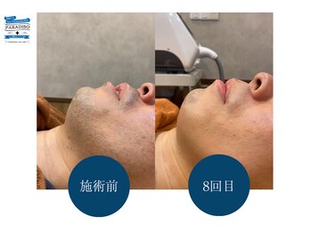 フィッティ プラス(fiti+)/最大マイナス15℃の冷却機能搭載