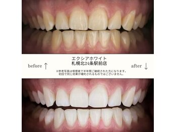 エクシアホワイト 平岸駅前店