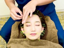 西川口みんなの鍼灸整骨院/しわ・たるみ改善にも効果的！