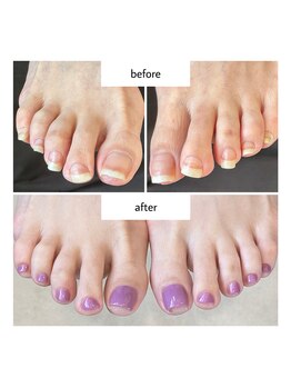 ネイルアトリエ ボン(nail atelier bon)/フットシェラック