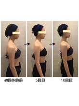 ハリーハリー 名古屋栄店(HARRY ハリー)/◆小顔コルギで姿勢改善◆