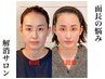 【面長・小顔矯正】頭蓋骨&小顔矯正/小顔リンパ/￥17000→￥8000