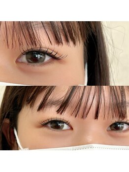 アンリミテッド(Unlimited)/フラットラッシュ