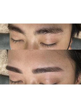 メンズフェイシャル