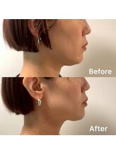 デディア 恵比寿(dedia)/洗練されたフェイスラインに