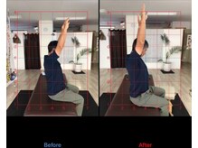 ストレチックス 近江八幡店/before/after