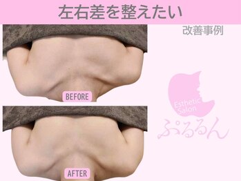 ぷるるんエステ/バストアップ/肩こり/リンパ