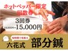 ★限定★肩こり・腰痛に【部分鍼3回券】通常18,000円⇒初回15,000円