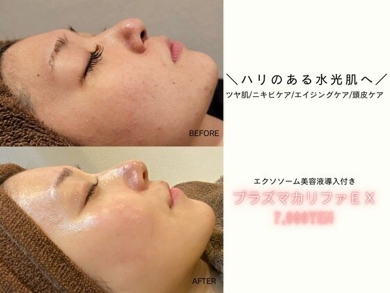 東京都でエレクトロポレーションが人気のエステサロン
