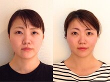 ウェリナ 一宮院/.【小顔矯正before→after】