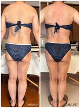 ジフィー(Gify)/筋膜リリースカッターBody