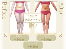 ピュアエステブリアント 銀座店/お客様の結果［銀座/痩身］