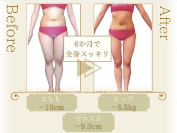 ピュアエステブリアント 銀座店/お客様の結果［銀座/痩身］