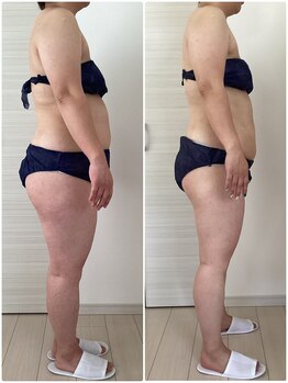 サロンドルフレ(salon de Reflet)/40代女性 △10kg