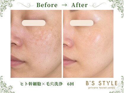 ビーズスタイル(B’S STYLE)の写真