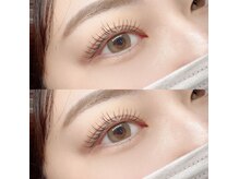 フーフロー(Fooflow)/フラットラッシュ100本