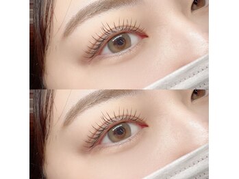 フーフロー(Fooflow)/フラットラッシュ100本