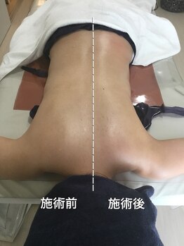 リセット(Reset.)/深層筋リンパ/ before → after