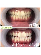 ルブラン 奈良店(Le Blanc)/こちらものお客様も