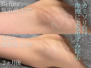 アリウム(ALLIUM)